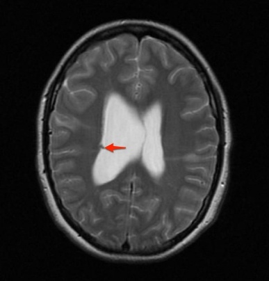 A close-up of a brain scan AI-generated content may be incorrect.