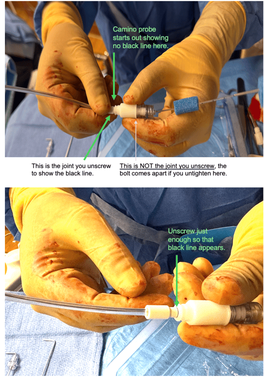 Figure 2: unscrewing the camino monitor to show the black line. 