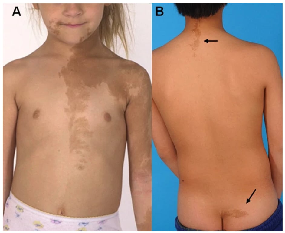 A close-up of a child's body AI-generated content may be incorrect.