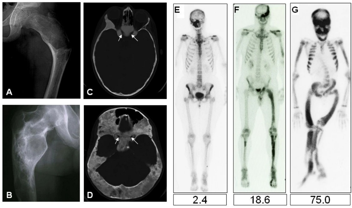A collage of x-ray images of a skeleton AI-generated content may be incorrect.