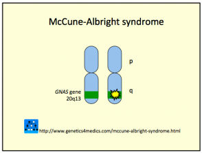 McCune Albright Syndrome