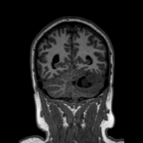 A close-up of a brain AI-generated content may be incorrect.