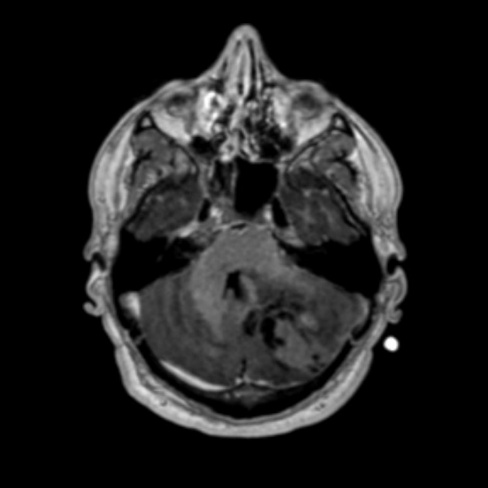 A close-up of a brain scan AI-generated content may be incorrect.