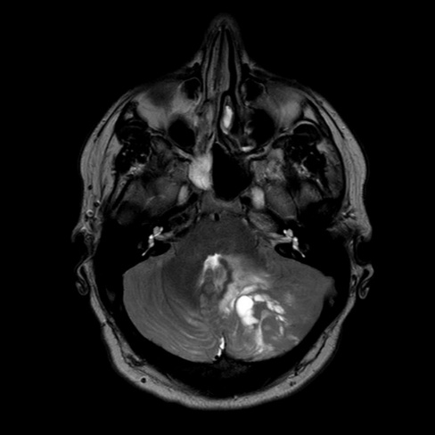 A mri of the brain AI-generated content may be incorrect.