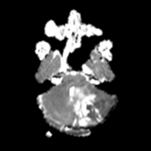 A close-up of a scan of a human body AI-generated content may be incorrect.