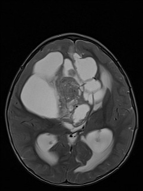 A close-up of a brain scan AI-generated content may be incorrect.