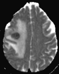 A close-up of a brain AI-generated content may be incorrect.