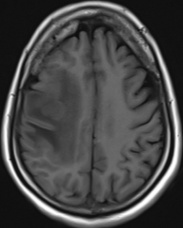 A close-up of a brain scan AI-generated content may be incorrect.