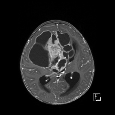 A close-up of a ct scan AI-generated content may be incorrect.