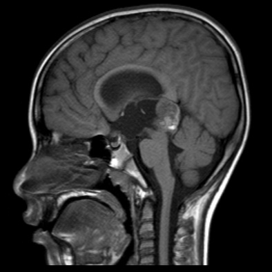 A close-up of a brain AI-generated content may be incorrect.