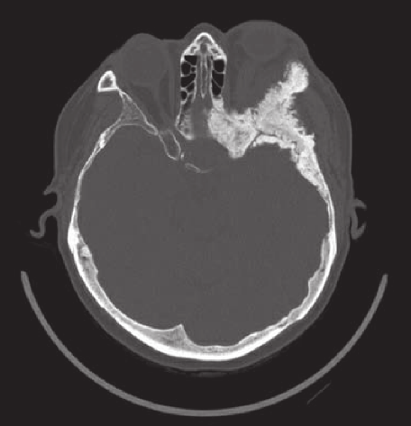 A close-up of a ct scan AI-generated content may be incorrect.