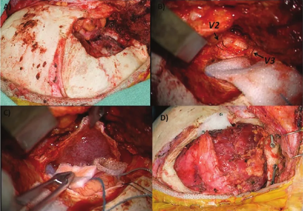 A collage of photos of a human body AI-generated content may be incorrect.