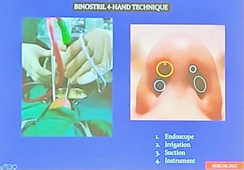 eooscop:c АРПОАСН 1rrigaHon З. 