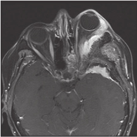 A close-up of a mri AI-generated content may be incorrect.