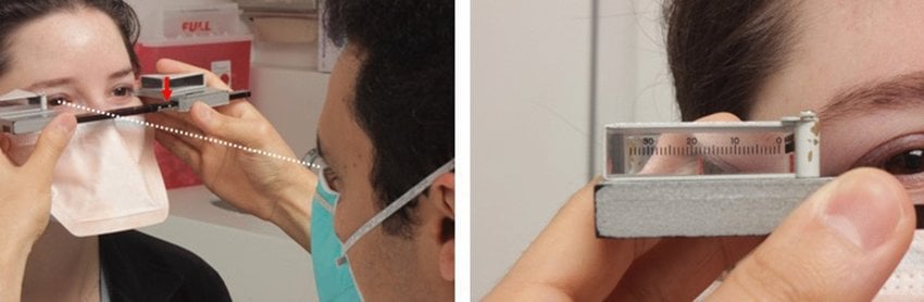 Hertel exophthalmometry. Left panel shows the clinician sitting at eye... | Download Scientific Diagram