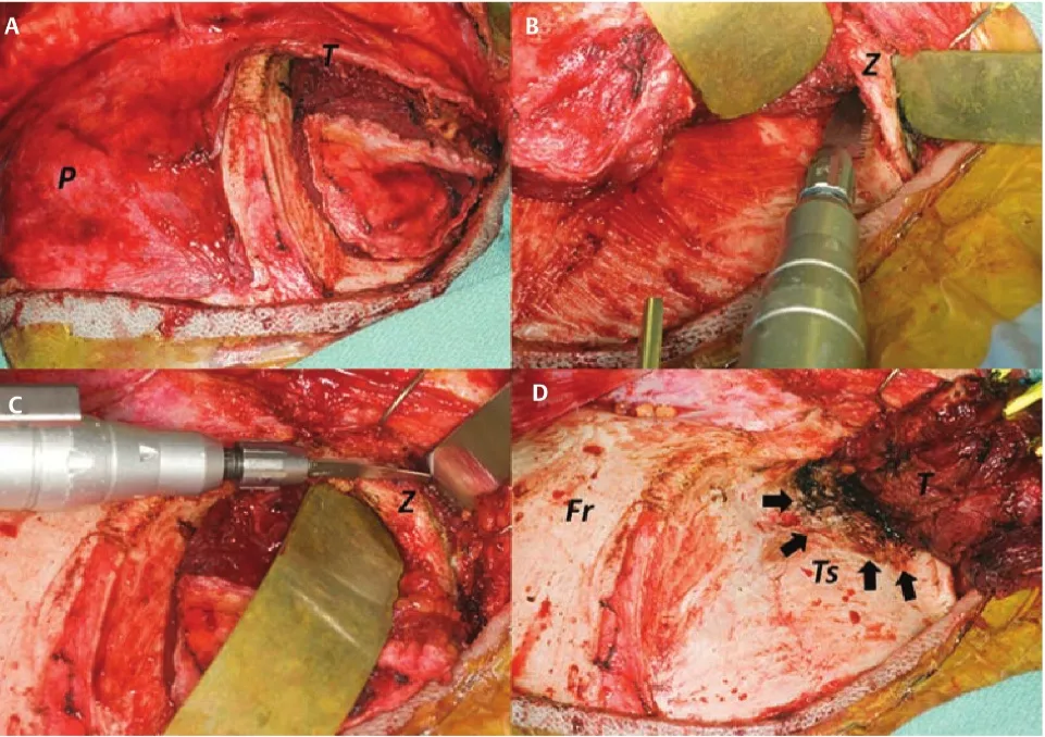Close-up of a heart AI-generated content may be incorrect.