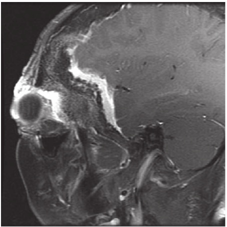 A close-up of a brain mri AI-generated content may be incorrect.