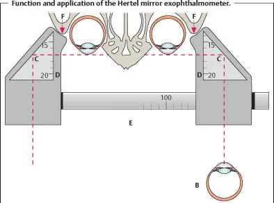 Cornea Disc Folds