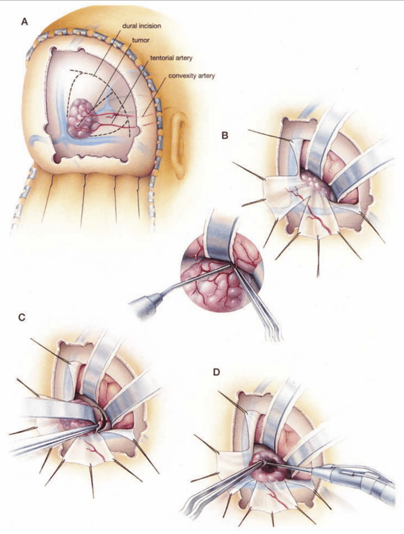 A diagram of a human brain AI-generated content may be incorrect.