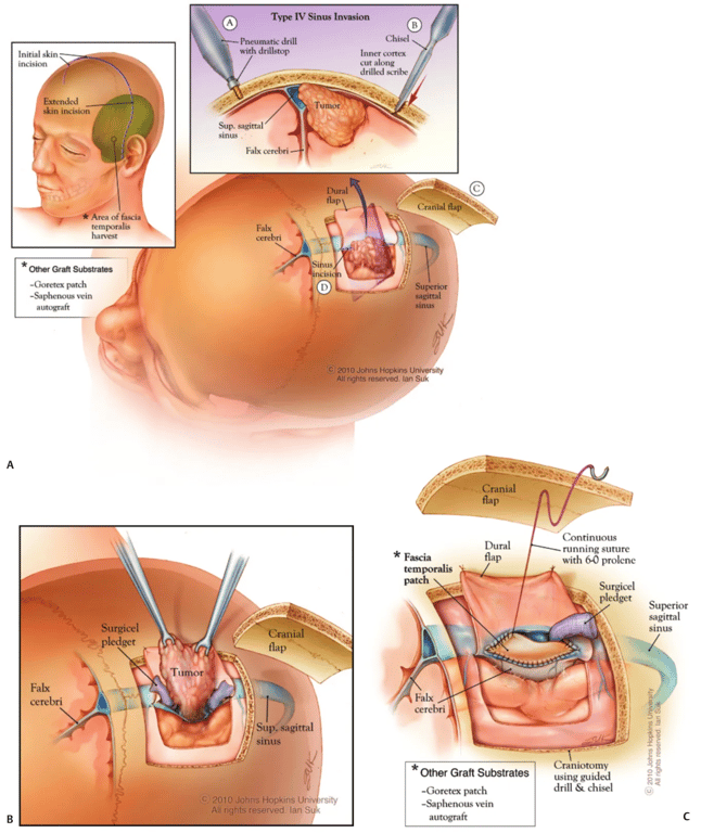 A diagram of the body AI-generated content may be incorrect.