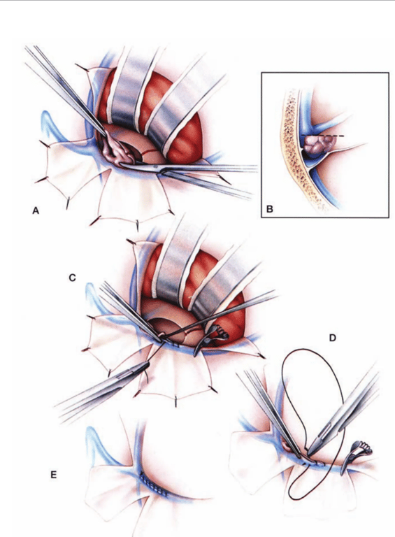 A diagram of the eye anatomy AI-generated content may be incorrect.