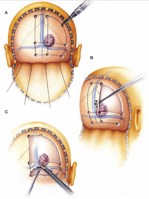 A diagram of the brain AI-generated content may be incorrect.