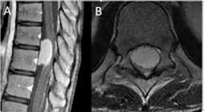 A close-up of an x-ray AI-generated content may be incorrect.