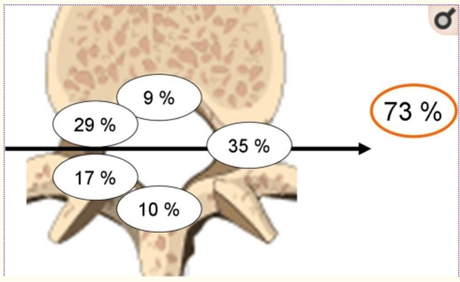 9% 73% 29 % 35 % 17% 10% 