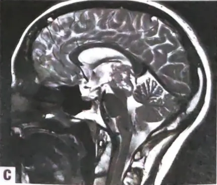 A close-up of an x-ray AI-generated content may be incorrect.