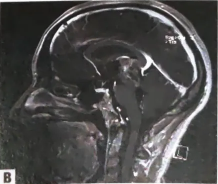 A close-up of an x-ray AI-generated content may be incorrect.