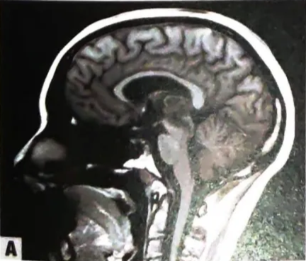 A close-up of an x-ray AI-generated content may be incorrect.