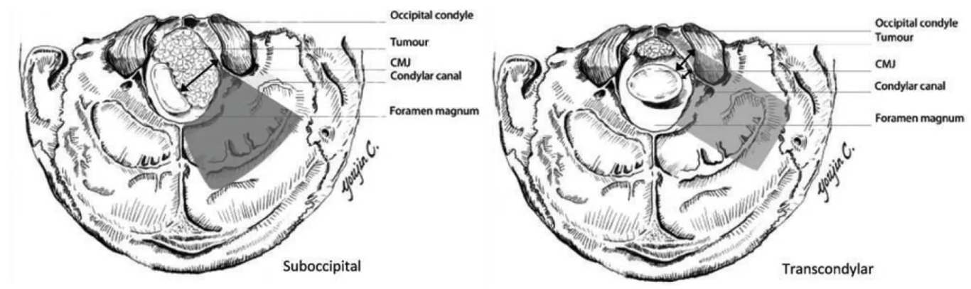 A diagram of the brain AI-generated content may be incorrect.