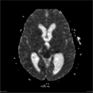 A ct scan of a brain AI-generated content may be incorrect.