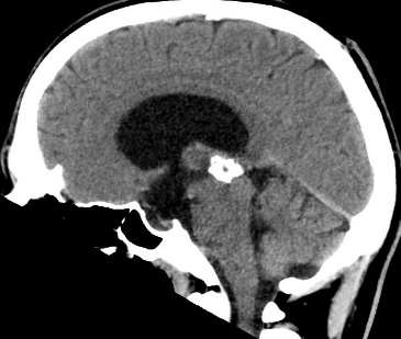 A close-up of a brain scan AI-generated content may be incorrect.