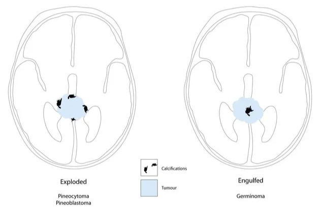 A diagram of the brain AI-generated content may be incorrect.