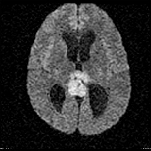 A close-up of a brain scan AI-generated content may be incorrect.