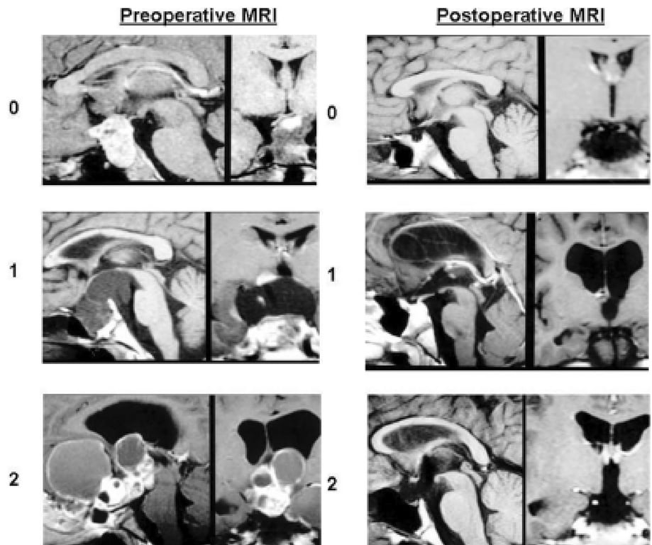 A collage of images of a brain AI-generated content may be incorrect.