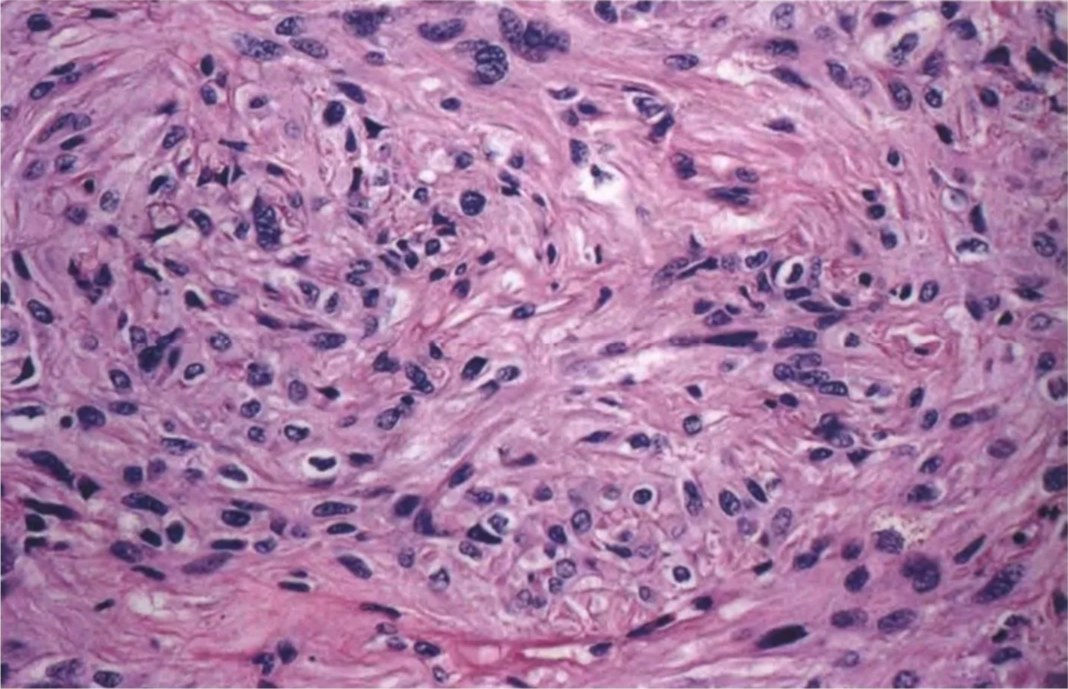 arranged in a fascicular pattern. 