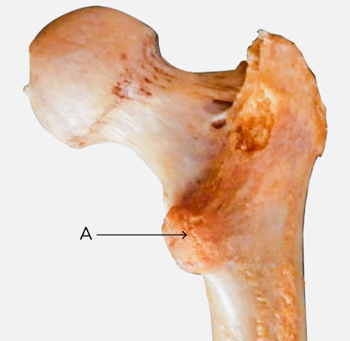 Lesser Trochanter