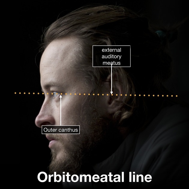 A person's face with text and lines AI-generated content may be incorrect.