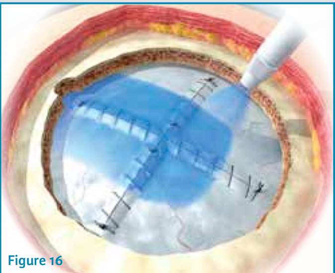 A close-up of a human eye AI-generated content may be incorrect.