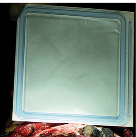 A plastic container with a blue border AI-generated content may be incorrect.