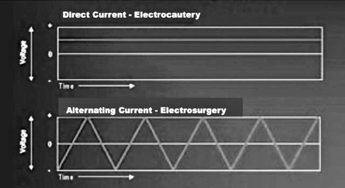 Direct Current • Electrocautery Alternating Current - Electrosurgery 