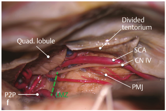 Close-up of a human body anatomy AI-generated content may be incorrect.