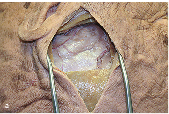 A close-up of a heart AI-generated content may be incorrect.