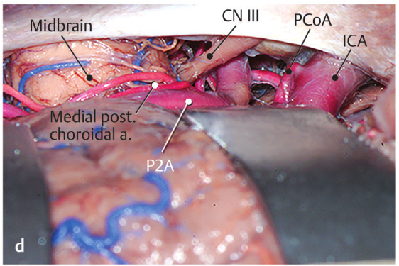 Close-up of a human body AI-generated content may be incorrect.