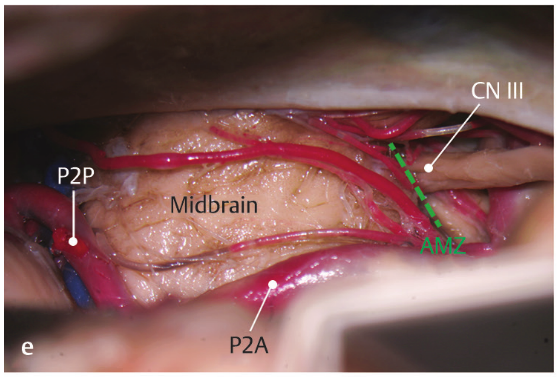 A diagram of the internal organs AI-generated content may be incorrect.