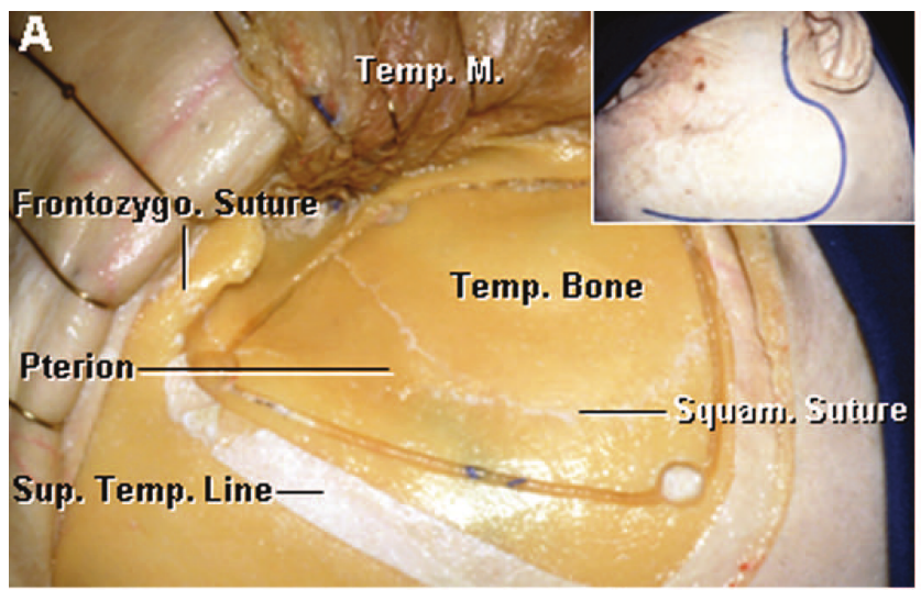 •rrrr.„ _ —atl!l •dtual auog •dtual 1dÊuëL 