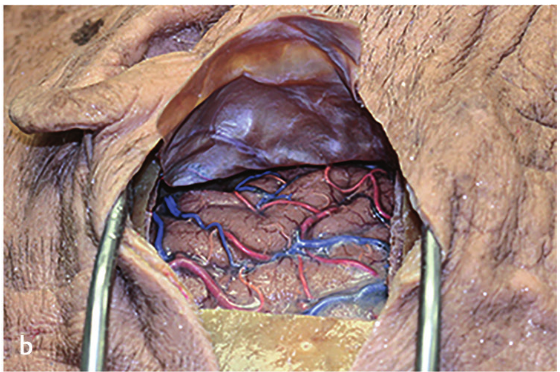 A close-up of a human body AI-generated content may be incorrect.