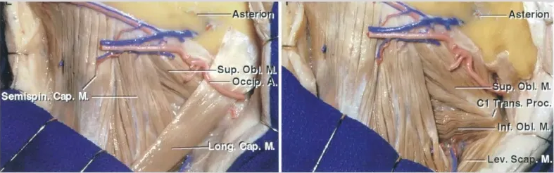 As sup. O Occ rio Asterio n . Proc. I . Obi. M Lev. S 